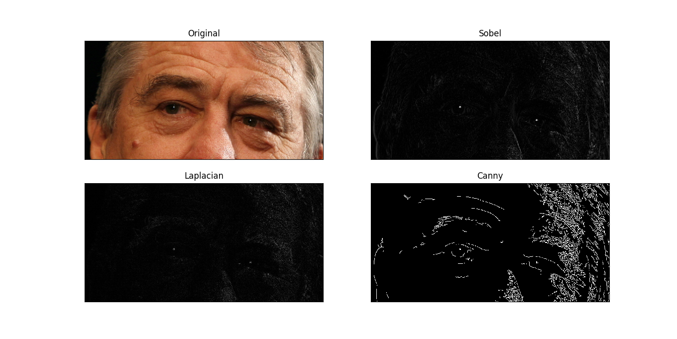 Comparison of edge detection methods Edge detection in the image